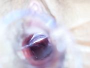 成绩优秀的可爱小胖妞屁股上长了好多痘痘 估计没草过几次